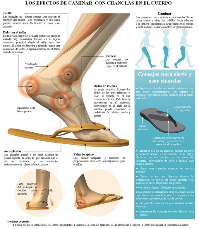 Osteomas osteopatia alcobendas lucas llamas efectos caminar chanclas pies