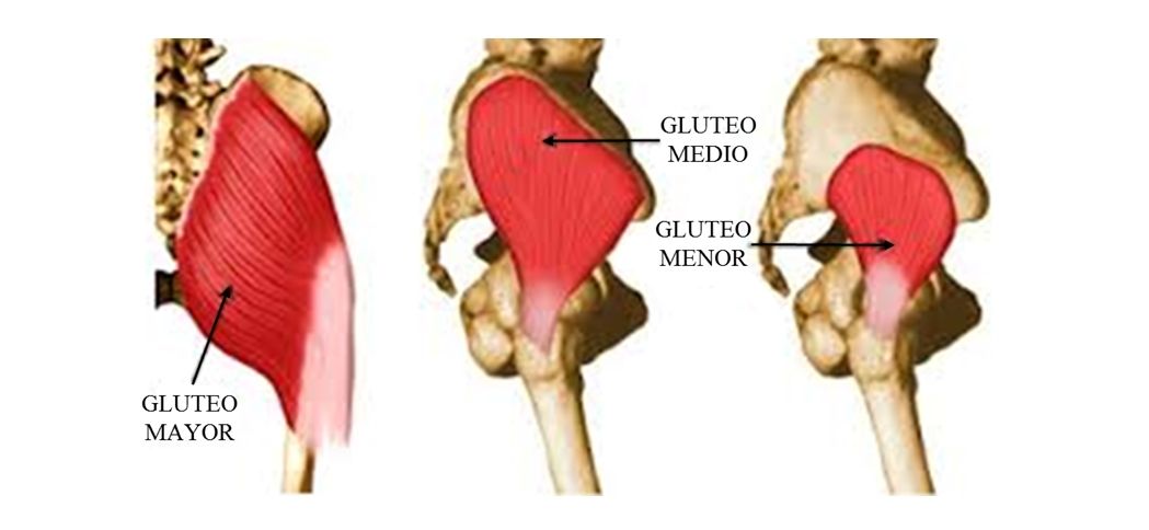 Osteomas SINDROME DEL TRASERO MUERTO O AMNESIA GLUTEA