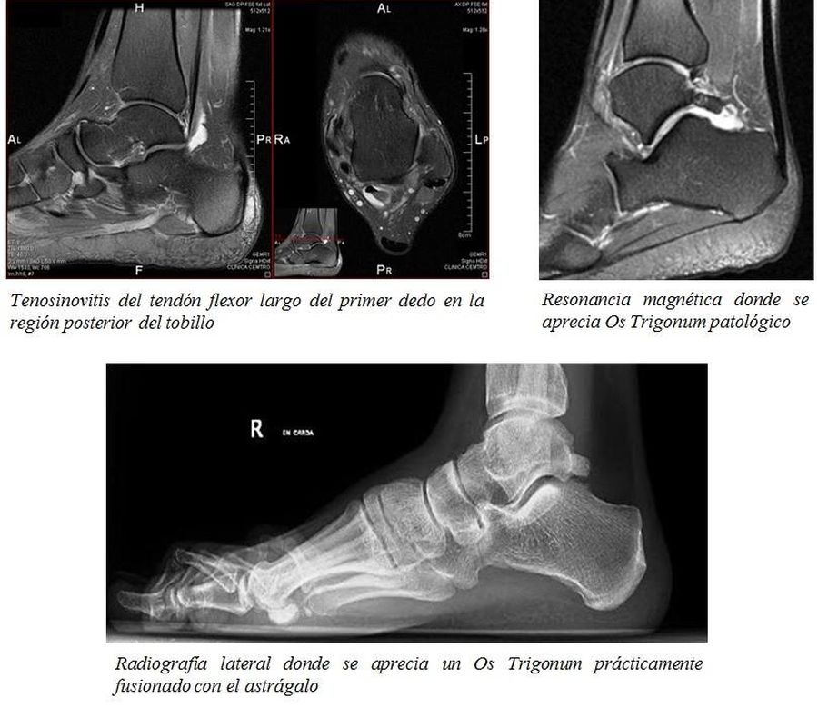 La osteopatia